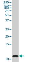 Anti-S100 A10 Mouse Polyclonal Antibody