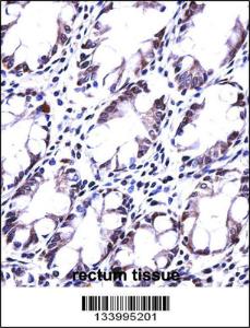 Anti-HRASLS5 Rabbit Polyclonal Antibody (APC (Allophycocyanin))