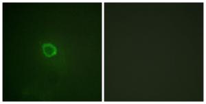 Immunofluorescence analysis of HepG2 cells using Anti-IL-13R alpha1 (phospho Tyr405) Antibody. The right hand panel represents a negative control, where the antibody was pre-incubated with the immunising peptide