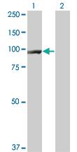 Anti-CTNNB1 Mouse Monoclonal Antibody [clone: 3A1]