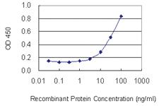 Anti-ABCG2 Mouse Monoclonal Antibody [clone: 1G1]