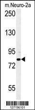 Anti-CPEB4 Rabbit Polyclonal Antibody (PE (Phycoerythrin))