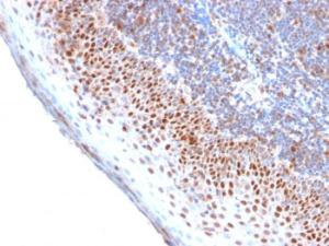 Immunohistochemical analysis of formalin-fixed, paraffin-embedded human tonsil using Anti-MCM7 Antibody [MCM7/2756R]