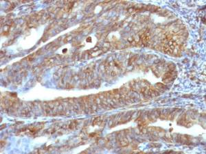 Immunohistochemical analysis of formalin-fixed, paraffin-embedded human uterus using Anti-Vimentin Antibody [VM1170]