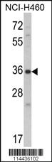 Anti-CTGF Rabbit Polyclonal Antibody