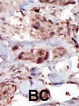 Anti-SPHK2 Rabbit Polyclonal Antibody