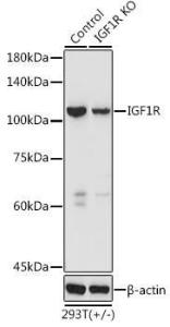 Anti-IGF1 Receptor antibody