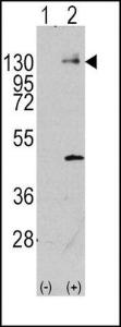 Anti-PDGFRA Rabbit Polyclonal Antibody (Biotin)