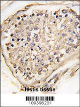 Anti-NPTX2 Rabbit Polyclonal Antibody (Biotin)