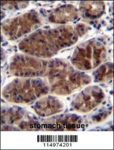 Anti-CTGF Rabbit Polyclonal Antibody