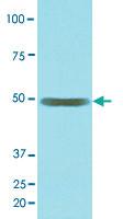 Anti-EPHX1 Mouse Monoclonal Antibody [clone: AT2E5]