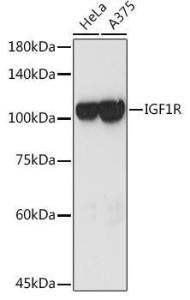 Anti-IGF1 Receptor antibody