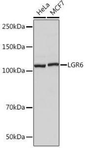 Western blot analysis of extracts of various cell lines, using Anti-GPCR LGR6 Antibody [ARC1440] (A305907) at 1:1,000 dilution. The secondary antibody was Goat Anti-Rabbit IgG H&L Antibody (HRP) at 1:10,000 dilution.