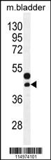 Anti-CTGF Rabbit Polyclonal Antibody