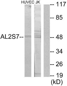 Western blot analysis of lysates from Jurkat and HUVEC cells using Anti-AL2S7 Antibody. The right hand lane represents a negative control, where the antibody is blocked by the immunising peptide.