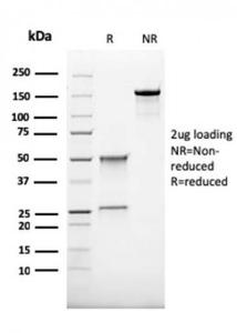 SDS-PAGE analysis of Anti-CD68 Antibody [rLAMP4/824] under non-reduced and reduced conditions; showing intact IgG and intact heavy and light chains, respectively. SDS-PAGE analysis confirms the integrity and purity of the Antibody