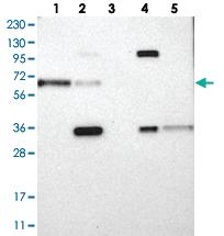 Anti-IL1RL1 Rabbit Polyclonal Antibody