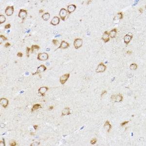 Immunohistochemistry analysis of paraffin-embedded mouse brain using Anti-MCL1 Antibody (A11132) at a dilution of 1:100 (40X lens). Perform high pressure antigen retrieval with 10 mM citrate buffer pH 6.0 before commencing with IHC staining protocol