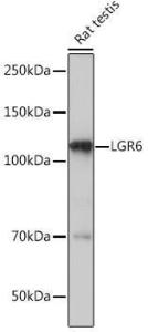 Western blot analysis of extracts of Rat testis, using Anti-GPCR LGR6 Antibody [ARC1440] (A305907) at 1:1,000 dilution. The secondary antibody was Goat Anti-Rabbit IgG H&L Antibody (HRP) at 1:10,000 dilution.