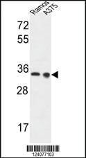 Anti-LDHA Rabbit Polyclonal Antibody