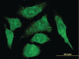 Anti-S100 A10 Mouse Monoclonal Antibody [clone: 4D2-F1]