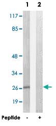 Anti-DHRS2 Rabbit Polyclonal Antibody