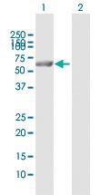 Anti-PPP6C Rabbit Polyclonal Antibody