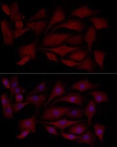 Immunofluorescence analysis of NIH/3T3 cells using Anti-MCL1 Antibody (A11132) at a dilution of 1:100 (40X lens). DAPI was used to stain the cell nuclei (blue)