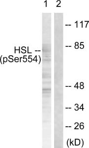 Western blot analysis of lysates from HeLa cells treated with Adriamycin 0.5 ng/ml 24h using Anti-HSL (phospho Ser855 + Ser554) Antibody. The right hand lane represents a negative control, where the antibody is blocked by the immunising peptide