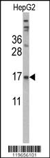 Anti-TTR Rabbit Polyclonal Antibody