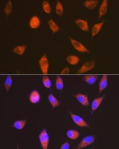 Immunofluorescence analysis of HeLa cells using Anti-GPCR LGR6 Antibody [ARC1440] (A305907) at a dilution of 1:100 (40x lens). DAPI was used to stain the cell nuclei (blue).