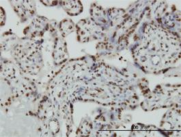 Anti-HMGB2 Mouse Monoclonal Antibody [clone: 3D2]