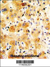 Anti-TTR Rabbit Polyclonal Antibody