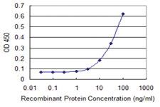 Anti-ETNK1 Mouse Monoclonal Antibody [clone: 1F3]