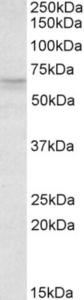 EB06526 (1 µg/ml) staining of HeLa lysate (35 µg protein in RIPA buffer). Primary incubation was 1 hour. Detected by chemiluminescence.