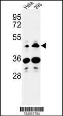 Anti-HS3ST2 Rabbit Polyclonal Antibody (AP (Alkaline Phosphatase))