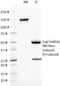 SDS-PAGE analysis of Anti-Ferritin Heavy Chain Antibody [FTH/2082] under non-reduced and reduced conditions; showing intact IgG and intact heavy and light chains, respectively. SDS-PAGE analysis confirms the integrity and purity of the antibody.