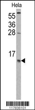 Anti-CCL2 Rabbit Polyclonal Antibody