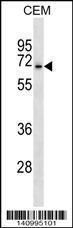 Anti-ASIC3 Rabbit Polyclonal Antibody (FITC (Fluorescein Isothiocyanate))