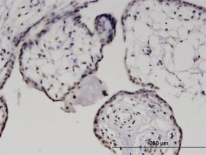 Anti-MXD1 Mouse Monoclonal Antibody [clone: 2G10]