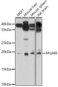 Western blot analysis of extracts of various cell lines, using Anti-MRPL48 Antibody (A308720) at 1:1000 dilution. The secondary Antibody was Goat Anti-Rabbit IgG H&L Antibody (HRP) at 1:10000 dilution. Lysates/proteins were present at 25 µg per lane