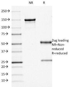 SDS-PAGE analysis of Anti-CD68 Antibody [KP1] under non-reduced and reduced conditions; showing intact IgG and intact heavy and light chains, respectively. SDS-PAGE analysis confirms the integrity and purity of the antibody.