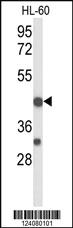 Anti-TNFRSF10D Rabbit Polyclonal Antibody