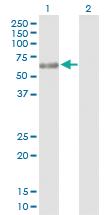 Anti-PPP6C Rabbit Polyclonal Antibody