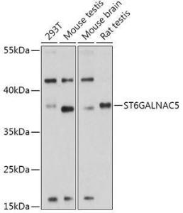 Anti-ST6GALNAC5 antibody