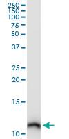 Anti-S100 A10 Mouse Monoclonal Antibody [clone: 3E10]