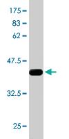 Anti-RPS6KA6 Mouse Monoclonal Antibody [clone: 3E2]