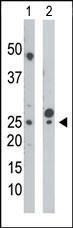 Anti-UCK1 Rabbit Polyclonal Antibody (AP (Alkaline Phosphatase))