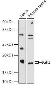 Western blot analysis of extracts of various cell lines, using Anti-IGF1 Antibody (A11137) at 1:1,000 dilution The secondary antibody was Goat Anti-Rabbit IgG H&L Antibody (HRP) at 1:10,000 dilution Lysates/proteins were present at 25 µg per lane