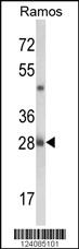 Anti-KCNMB1 Rabbit Polyclonal Antibody